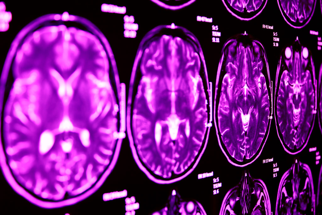 Open MRI Services Long Island Jericho Specialty Imaging