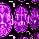 Jericho Specialty Imaging MRI Services