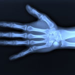 X-Ray Services